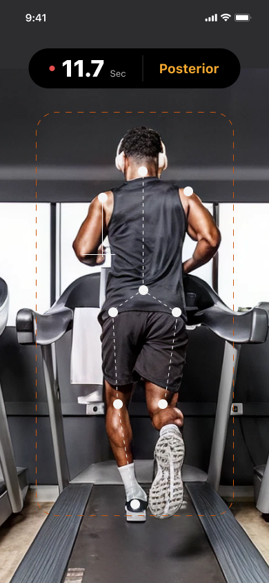 Live posterior gait analysis